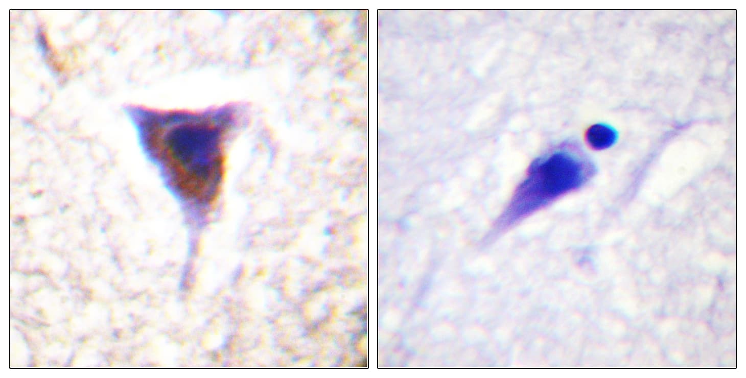 MTOR Antibody (phospho-Ser2481)