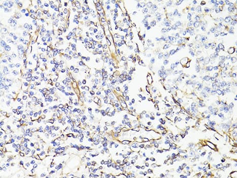 Vimentin Antibody