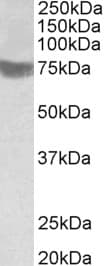 IHC-plus™ Polyclonal Goat anti-Human RNF139 / TRC8 Antibody (aa651-663, IHC, WB)