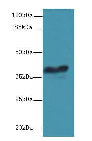 GPCRW / GPR18 Antibody