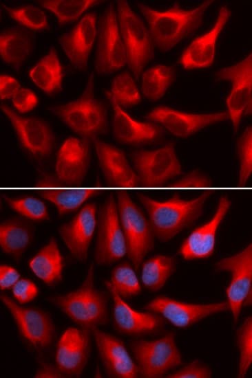 Polyclonal Rabbit anti-Human DDX3 / DDX3X Antibody (IHC, IF, WB)