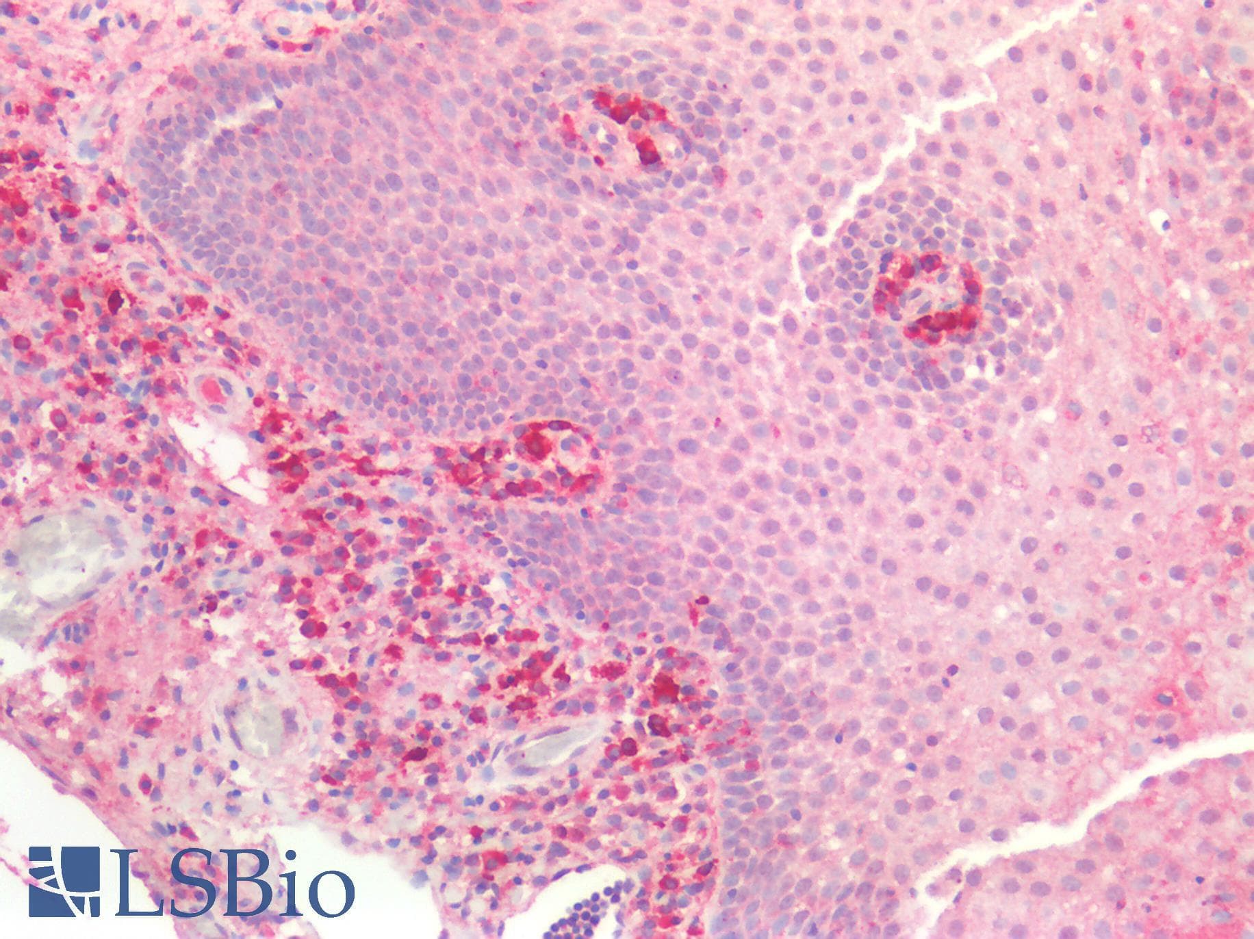 PathPlus™ MLPH / Melanophilin Antibody