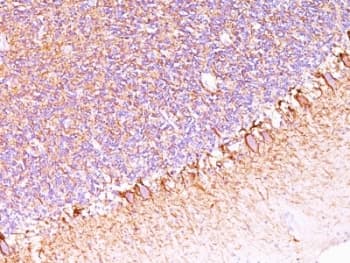 Neurofilament Antibody (clone SPM563)