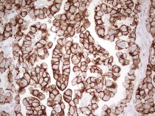 Monoclonal Mouse anti-Human ABCB1 / MDR1 / P Glycoprotein Antibody (clone OTI11D2, aa995-1280, IHC)