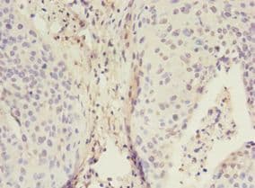 ADA / Adenosine Deaminase Antibody (aa157-343)