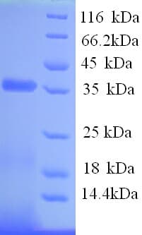 Saccharomyces cerevisiae CDA2 / Chitin Deacetylase 2 Protein (Recombinant His)