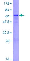 Human HUM2DD / DHDH Protein (Recombinant GST)