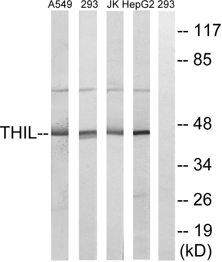 IHC-plus™ ACAT1 Antibody (aa221-270)