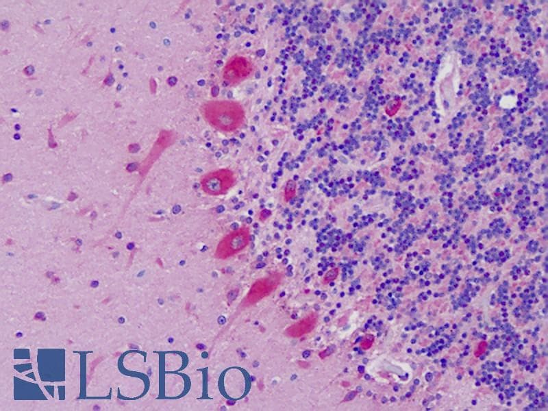 IHC-plus™ EFNA1 / Ephrin A1 Antibody (aa66-115)