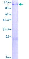 Human CPT1A Protein (Recombinant GST)
