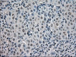 Monoclonal Mouse anti-Human CRYAB / Alpha B Crystallin Antibody (clone OTI2A1, IHC, IF, WB)