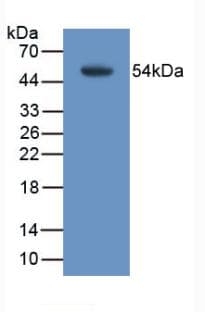 TMEM27 / Collectrin Antibody