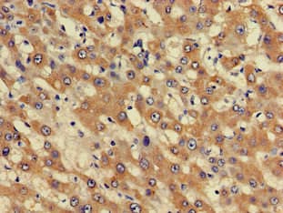PHF21A / BHC80 Antibody