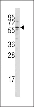 Polyclonal Rabbit anti-Human KAT5 / TIP60 Antibody (aa33-64, WB)