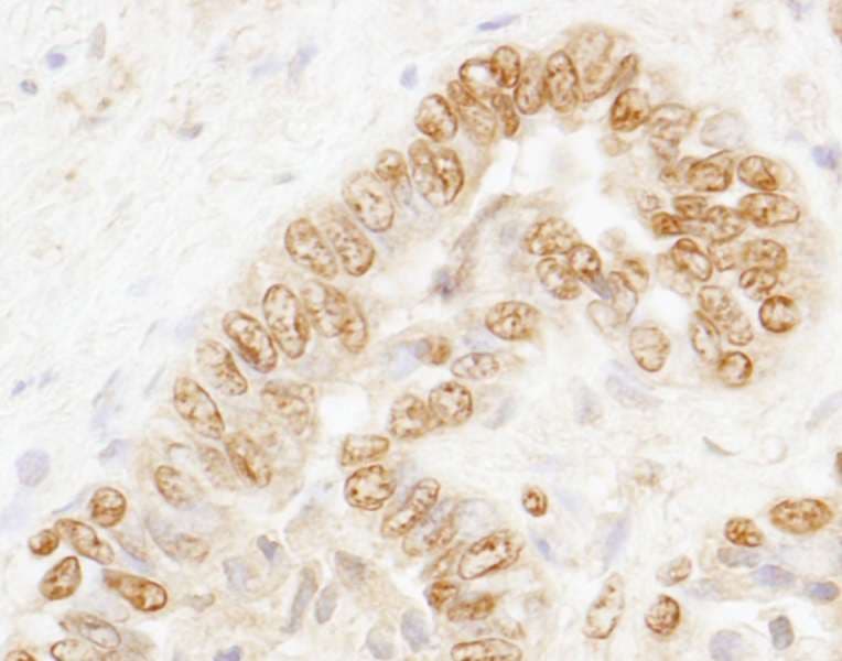 Polyclonal Rabbit anti-Human CSTF3 Antibody (aa1-50, IHC, WB)