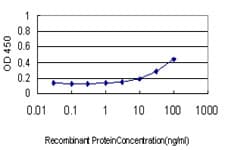 RPL19 / Ribosomal Protein L19 Antibody (clone 3H4)