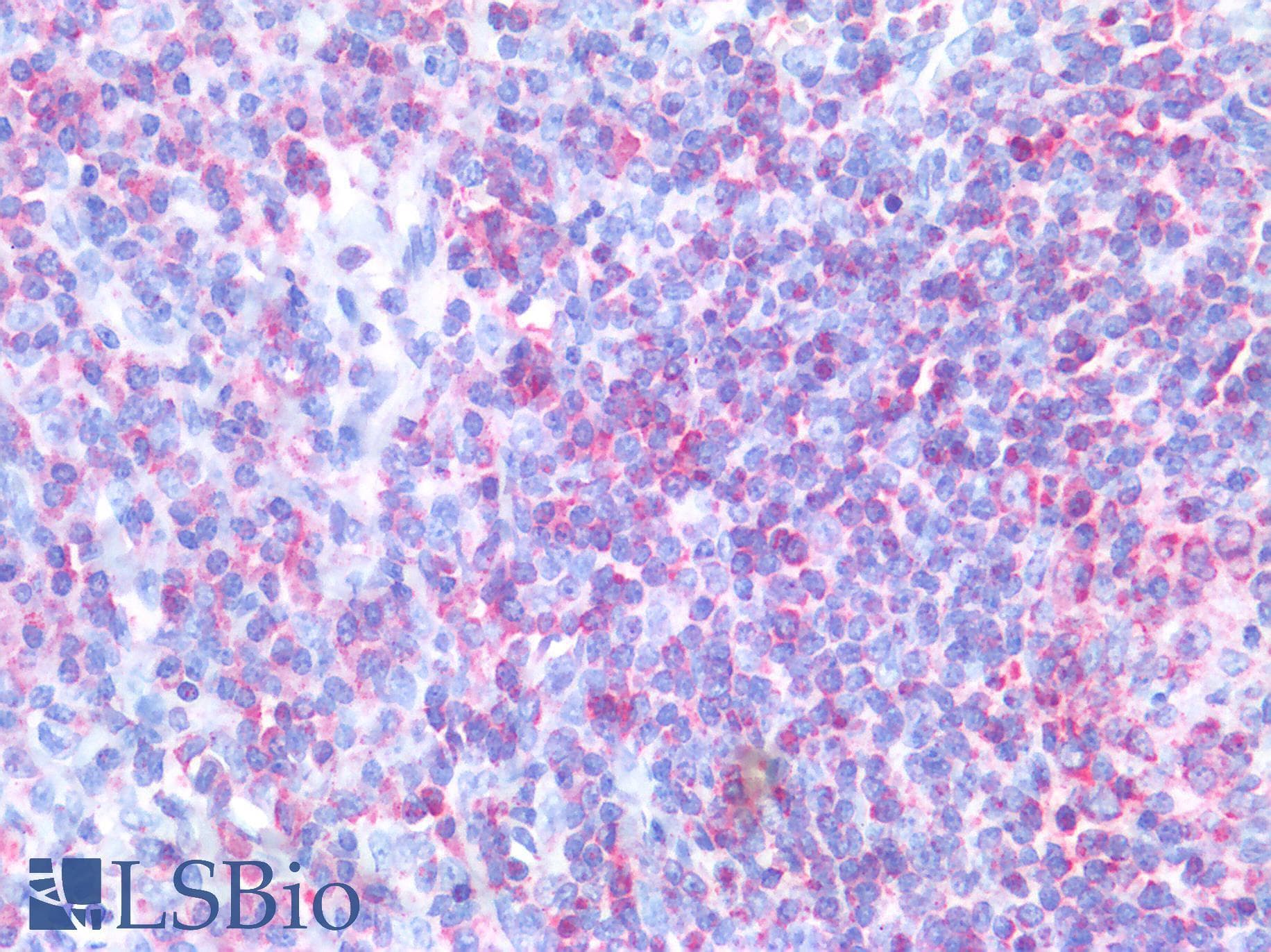 PathPlus™ ABCA7 Antibody