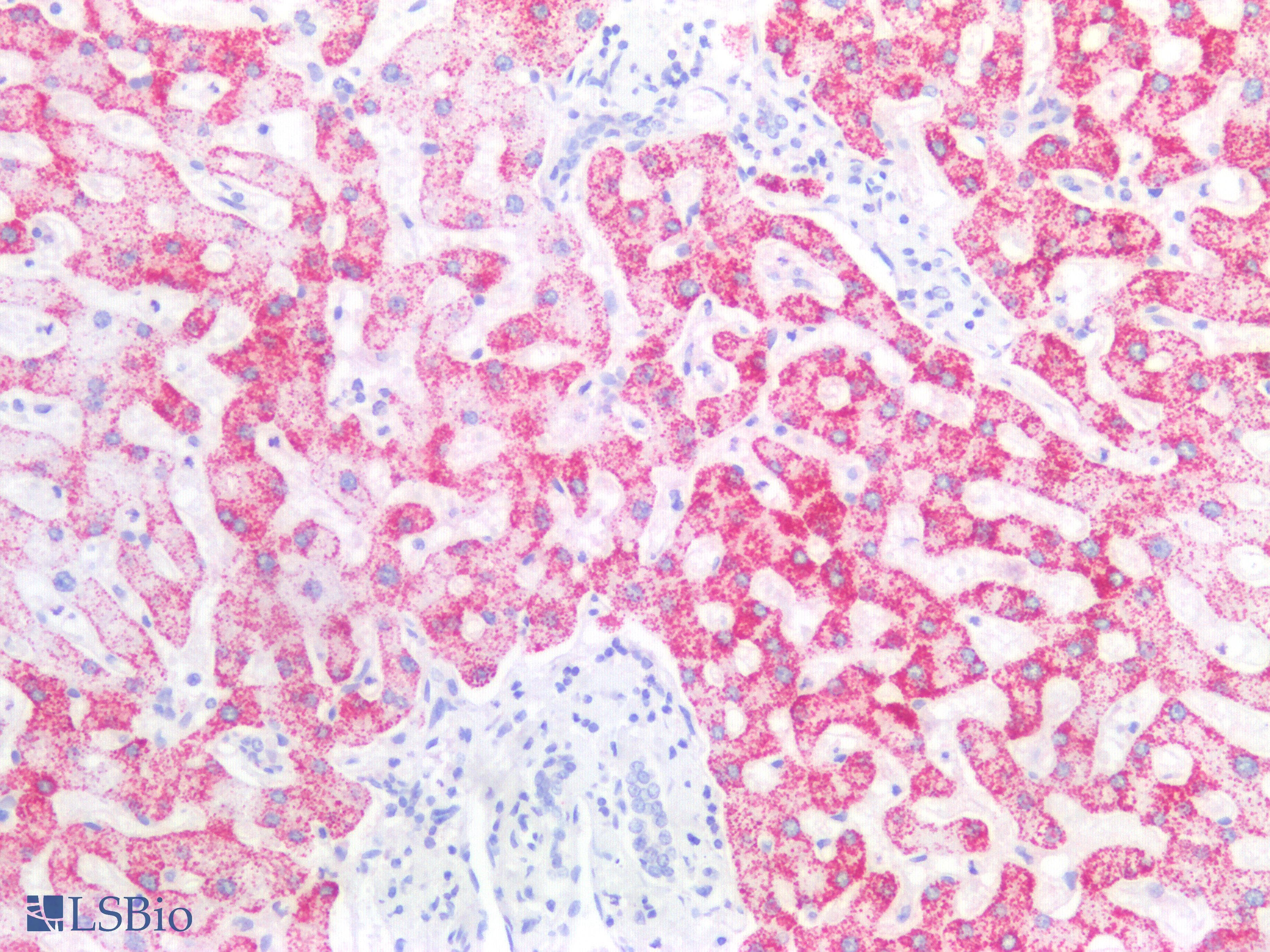 PathPlus™ Hepatocyte Specific Antigen Antibody (clone OCH1E5)