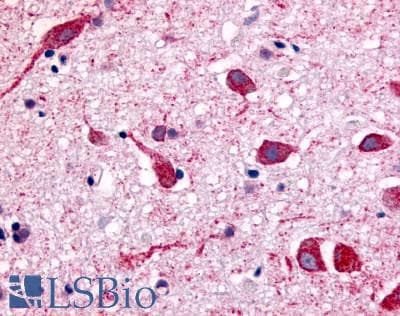 PathPlus™ Polyclonal Rabbit anti-Human CHRM2 / M2 Antibody (Cytoplasmic Domain, IHC)