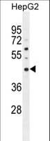 Polyclonal Rabbit anti-Human SATL1 Antibody (aa322-351, WB)
