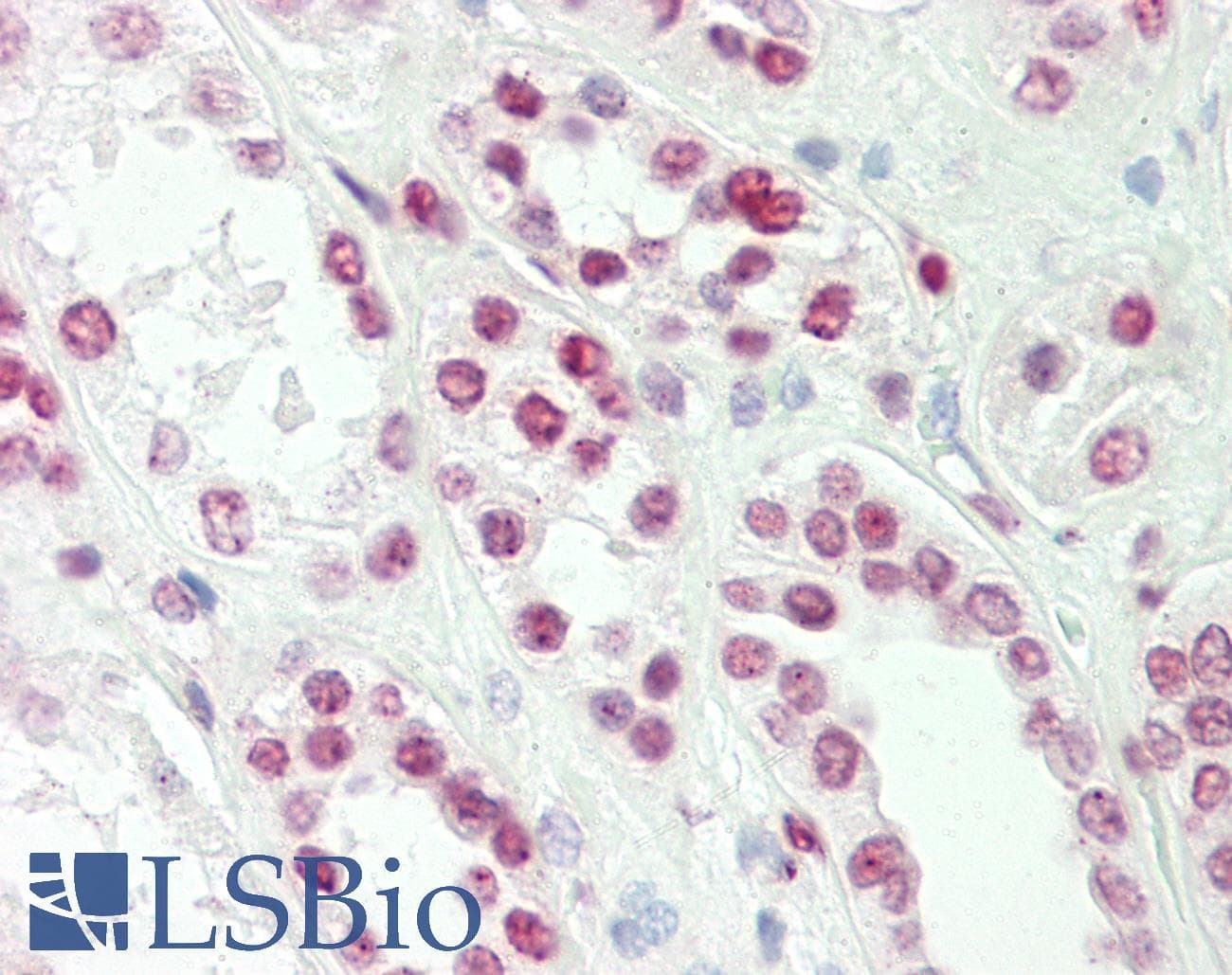IHC-plus™ TLX1 / HOX11 Antibody (aa163-191)