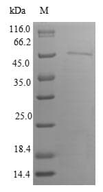 Human IRGM / LRG-47 Protein (Recombinant GST, N-terminus)