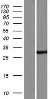DDHD2 Protein (Over-Expression Lysate Myc-DDK (Flag))