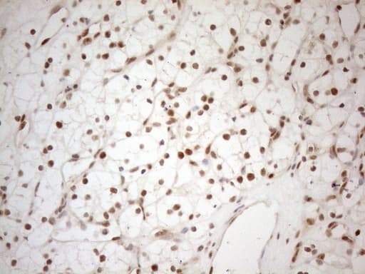 Monoclonal Mouse anti-Human RGL2 Antibody (clone OTI10F2, aa547-777, IHC, WB)