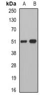 IHC-plus™ Polyclonal Rabbit anti-Human PNLIP / PL / Pancreatic Lipase Antibody (IHC, WB)