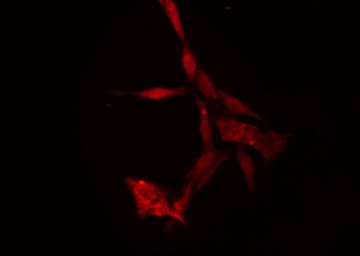 RPS18 / Ribosomal Protein S18 Antibody