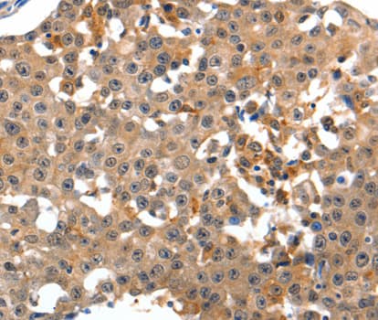 Polyclonal Rabbit anti-Human GRM1 / MGLUR1 Antibody (IHC, WB)