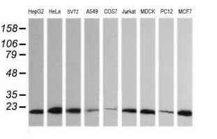 HRAS / H-Ras Antibody (clone OTI1D9)