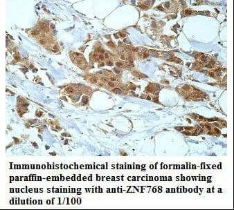 Polyclonal Rabbit anti-Human ZNF768 Antibody (aa20-243, IHC, WB)