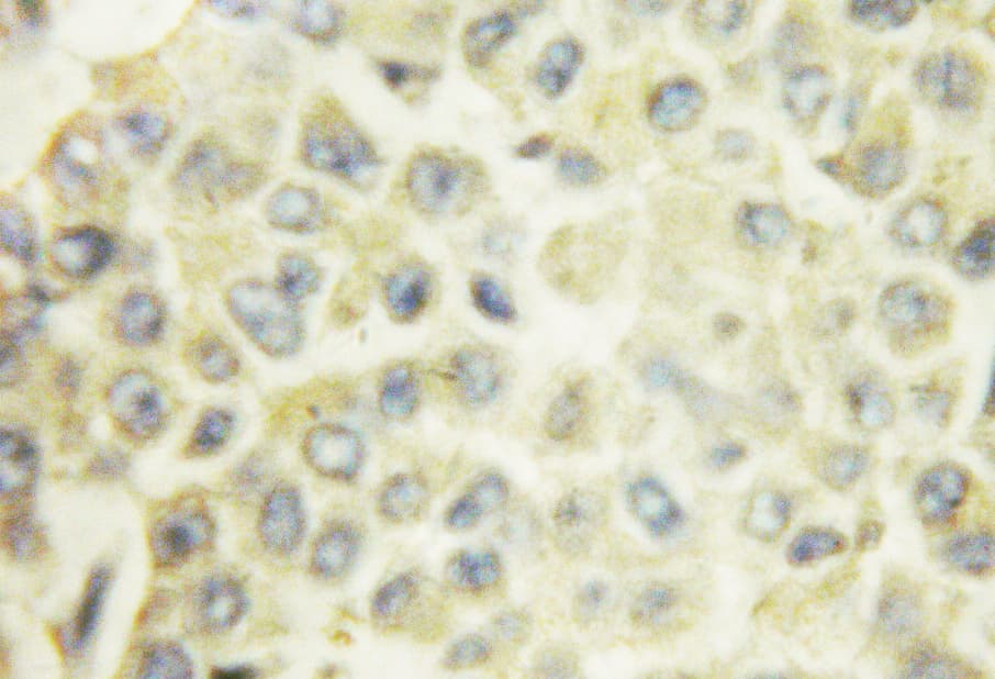 PRKCA / PKC-Alpha Antibody (phospho-Thr497)