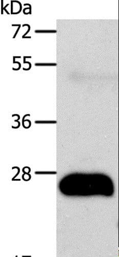 AGPAT2 Antibody