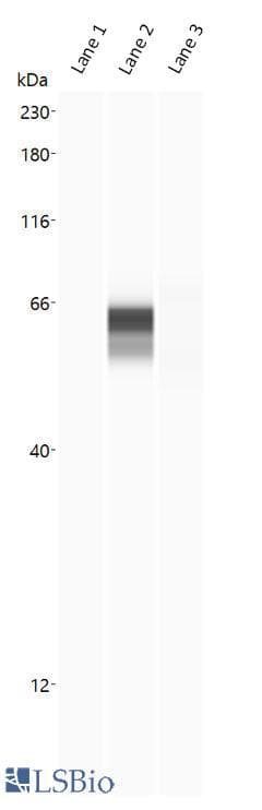 PathPlus™ ACE2 / ACE-2 Antibody