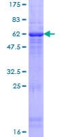 Human HP / Haptoglobin Protein (Recombinant GST)