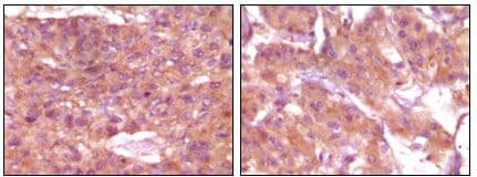 SRA1 / SRA Antibody (clone 1D4H8)