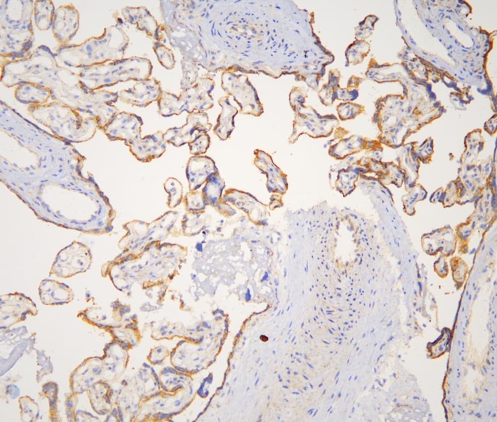 CTTN / Cortactin Antibody