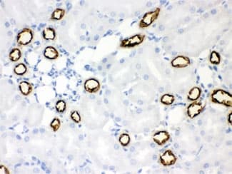 SLC12A1 / NKCC2 Antibody