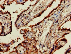 Polyclonal Rabbit anti-Human TRF1 / TERF1 Antibody (IHC)