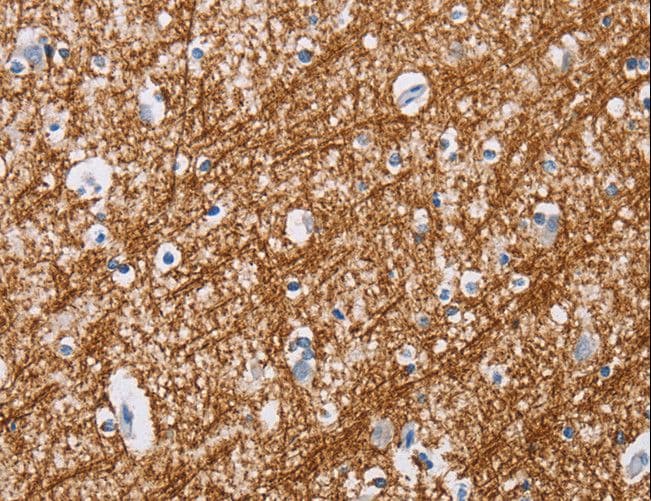 Polyclonal Rabbit anti-Human MAG Antibody (IHC, WB)