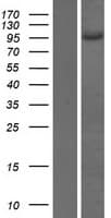 AP1B1 / BAM22 Protein (Over-Expression Lysate Myc-DDK (Flag))