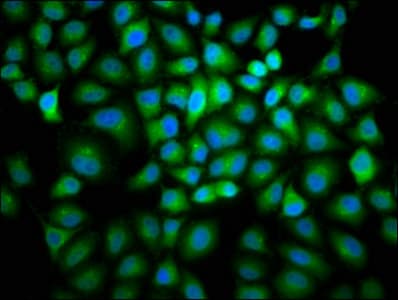 CCNB2 / Cyclin B2 Antibody