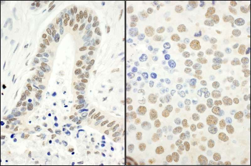 Polyclonal Rabbit anti-Human RPA2 / RFA2 / RPA34 Antibody (phospho-Ser4/8, IHC, IF, WB)