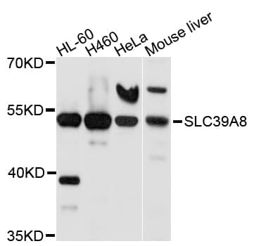 SLC39A8 / ZIP8 Antibody