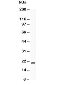 BCL2L2 / Bcl-w Antibody (aa74-88)