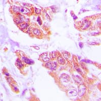 HSPH1 / HSP105 Antibody (C-Terminus)