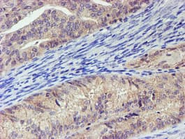 LECT2 Antibody (aa19-151, clone OTI2A11, Carrier-free)
