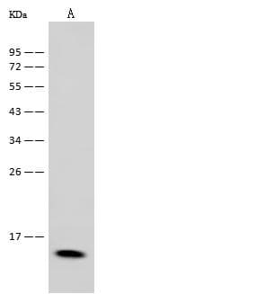 LGALS1 / Galectin 1 Antibody (Preservative Free)